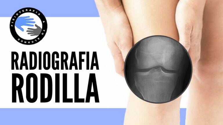 Necesitará radiografía tras lesión en la rodilla