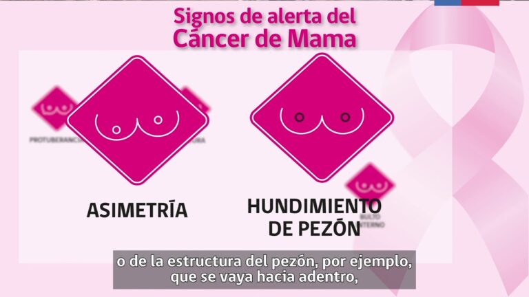 Importancia de la detección temprana del cáncer de mama y su impacto en los costos de tratamiento